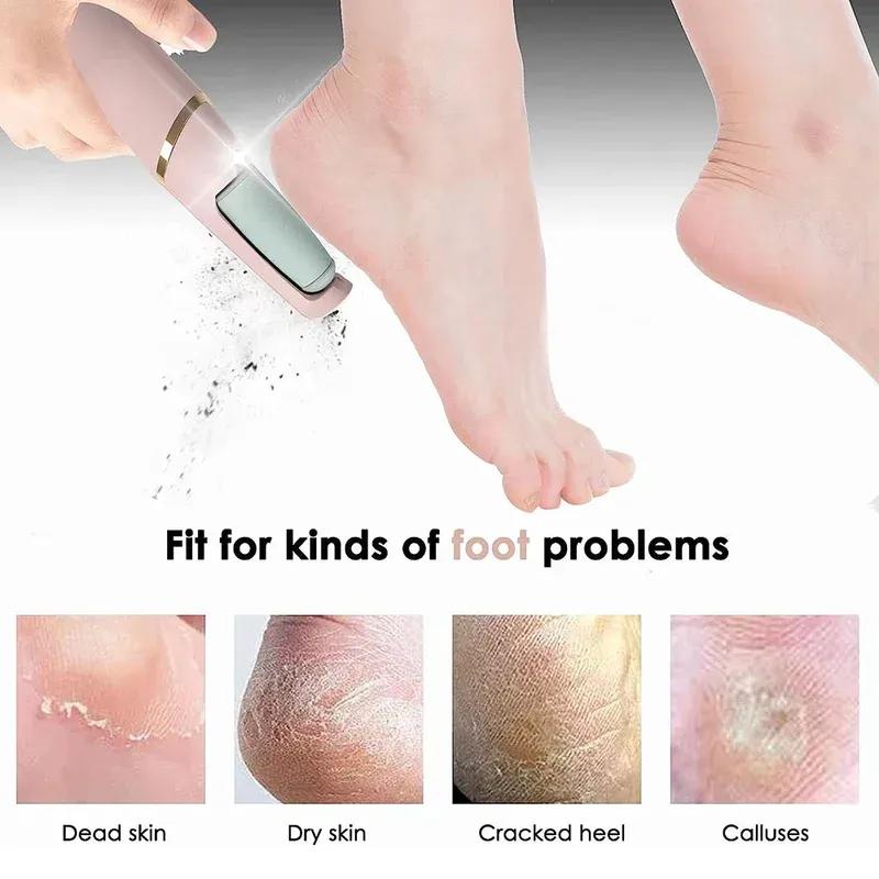 Electric Foot Callus Remover and Pedicure Grinder - Glint Glow